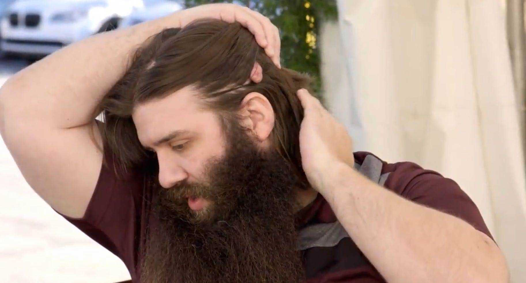 Ein Mann teilt sein Haar hinter seinem Kopf, um eine der Zysten zu zeigen, die während einer Episode von 