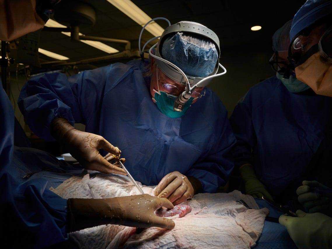 Ein Chirurg in blauer Kleidung und Schutzkleidung beugt sich während eines bahnbrechenden Transplantationsverfahrens über einen verdeckten Patienten auf einem Operationstisch