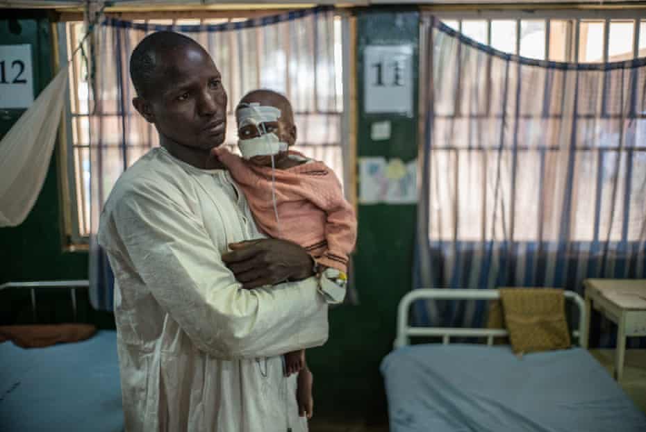 Grema und sein Sohn Mohammed kamen nach einer zweitägigen Reise im Krankenhaus an, aber Mohammeds Gesicht war bereits entstellt.