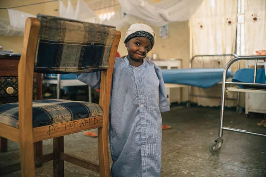 Sakina, eine 4-jährige Noma-Überlebende aus dem Bundesstaat Sokoto im Noma Hospital im Jahr 2016.