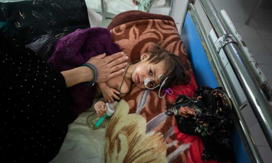 Die dreijährige Khalida wird wegen Unterernährung behandelt.