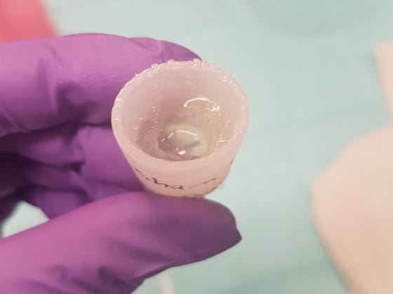 Biodome-Silikonkappe mit Seidengel im Inneren, das Medikamente für das Nachwachsen der Gliedmaßen enthält