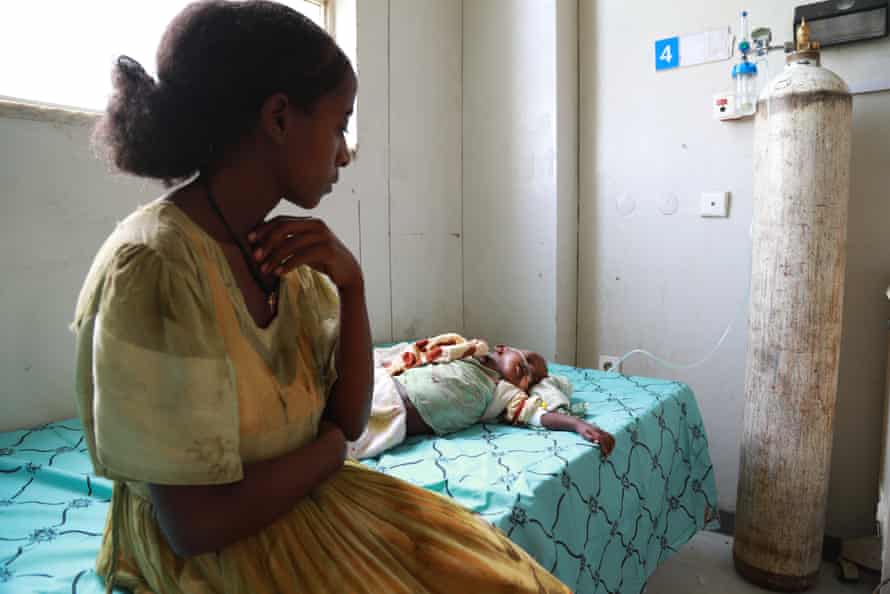 Eine Mutter blickt auf ihr schwer unterernährtes Baby, das neben ihr auf dem Bett liegt und Sauerstoff aus einem Tank erhält 