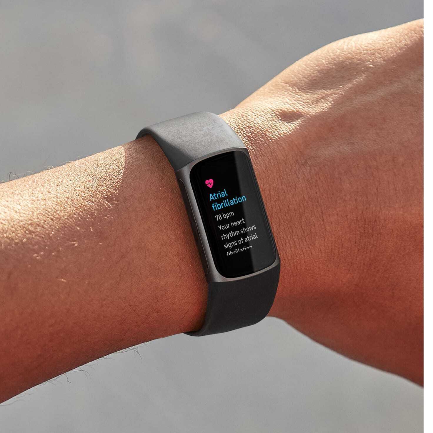 Bestimmte Fitbit-Modelle unterstützen EKG-Messungen zur Erkennung von Vorhofflimmern – Fitbit erhält die FDA-Zulassung, seinen Algorithmus zur Erkennung einer schweren Herzerkrankung zu verwenden