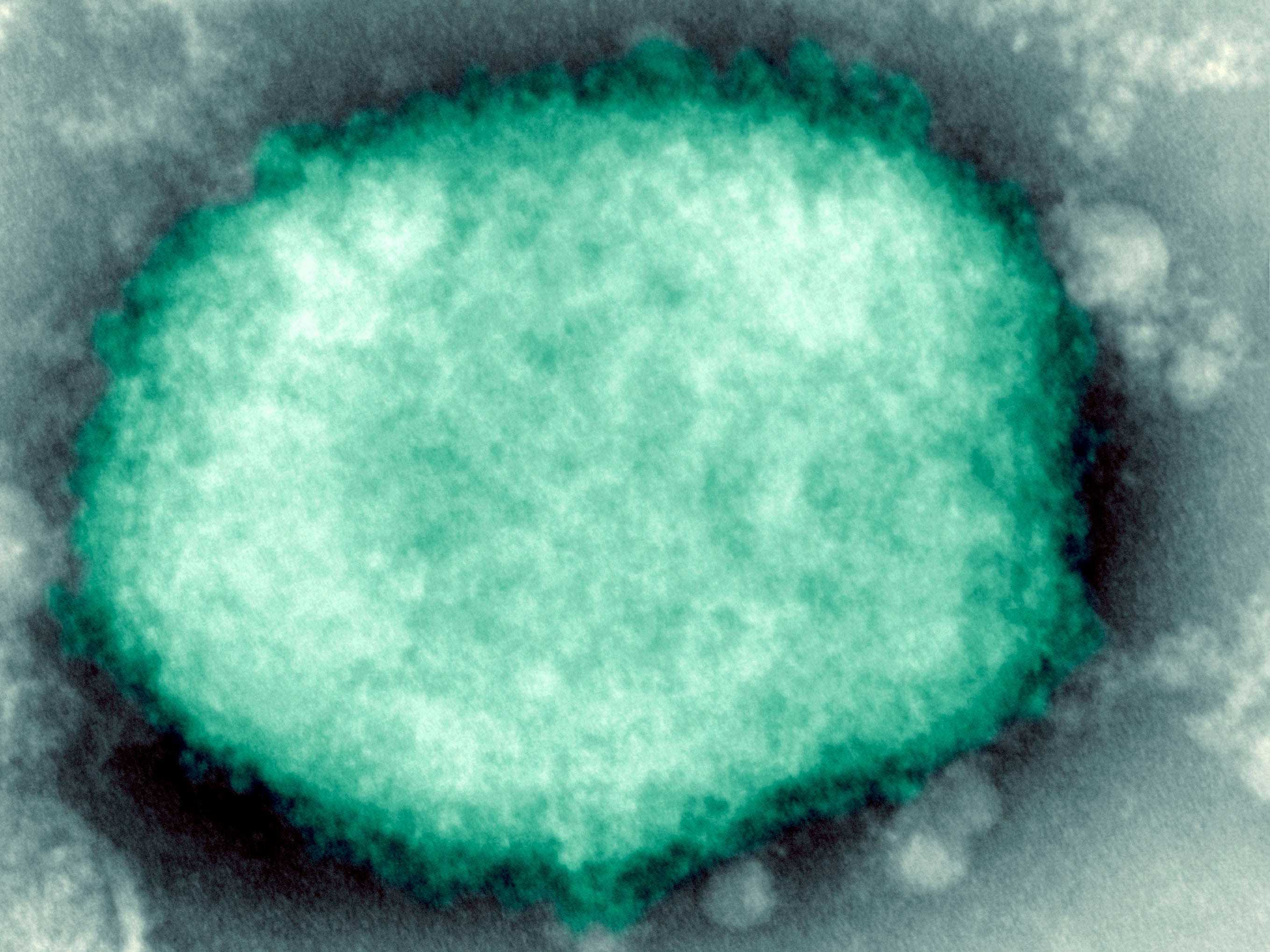 Affenpockenvirus in menschlicher Vesikelflüssigkeit vorhanden.