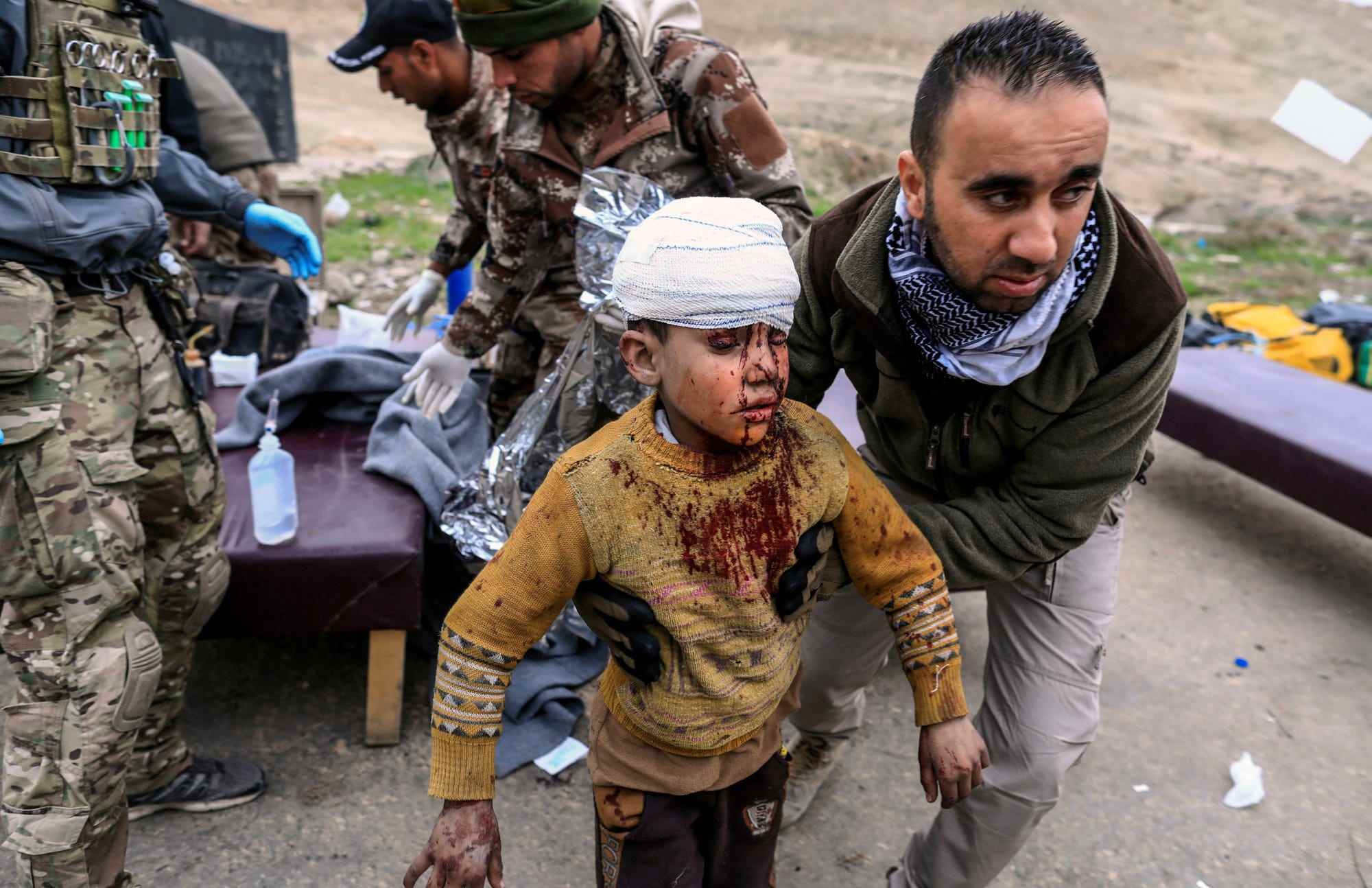 Ein bei einem Mörserangriff verletzter Junge geht auf einen Krankenwagen zu, nachdem er von Medizinern in einer Feldklinik behandelt wurde, während die irakischen Streitkräfte am 2.