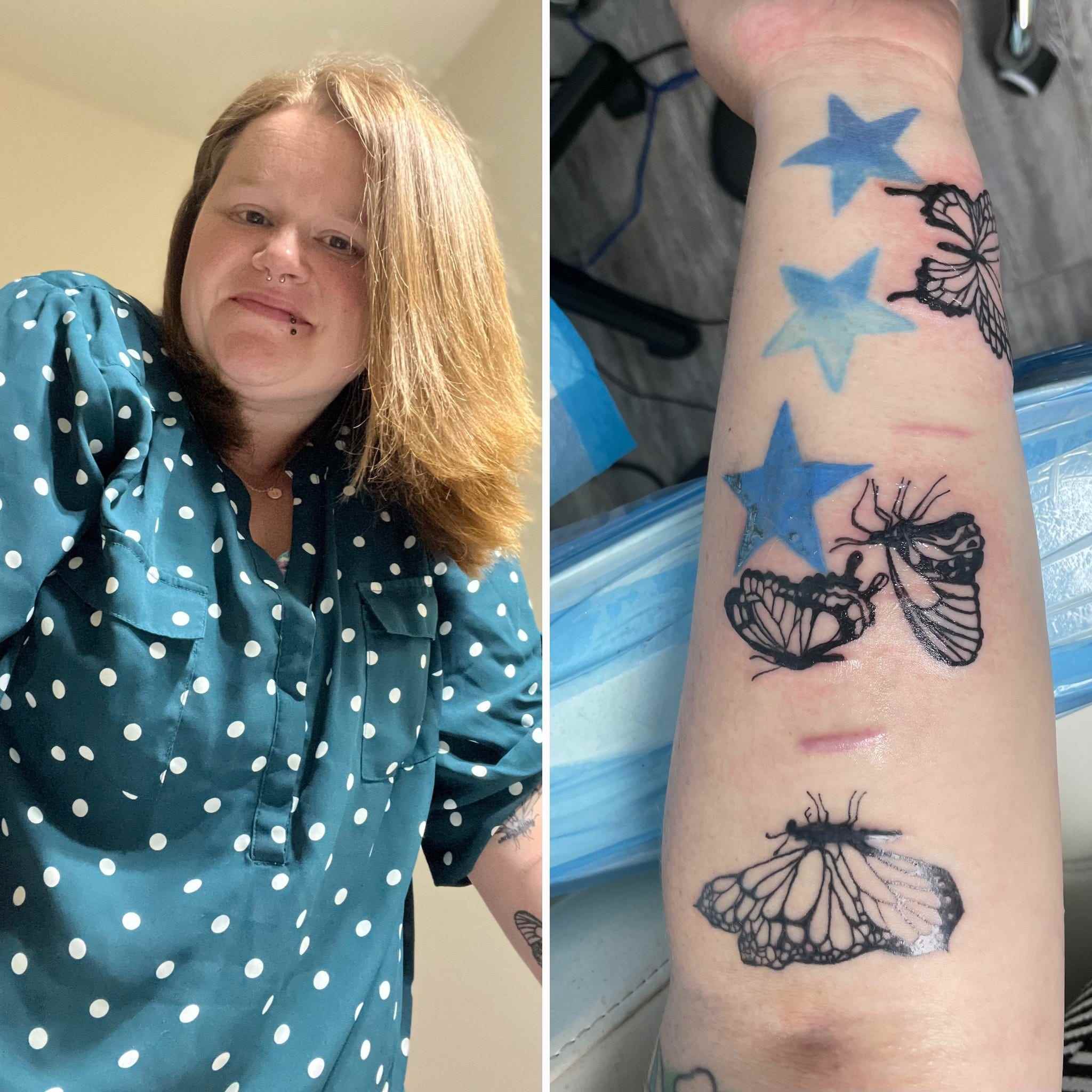Samantha Warmbrodt und ein Bild der medizinischen Tattoos auf ihrem Arm