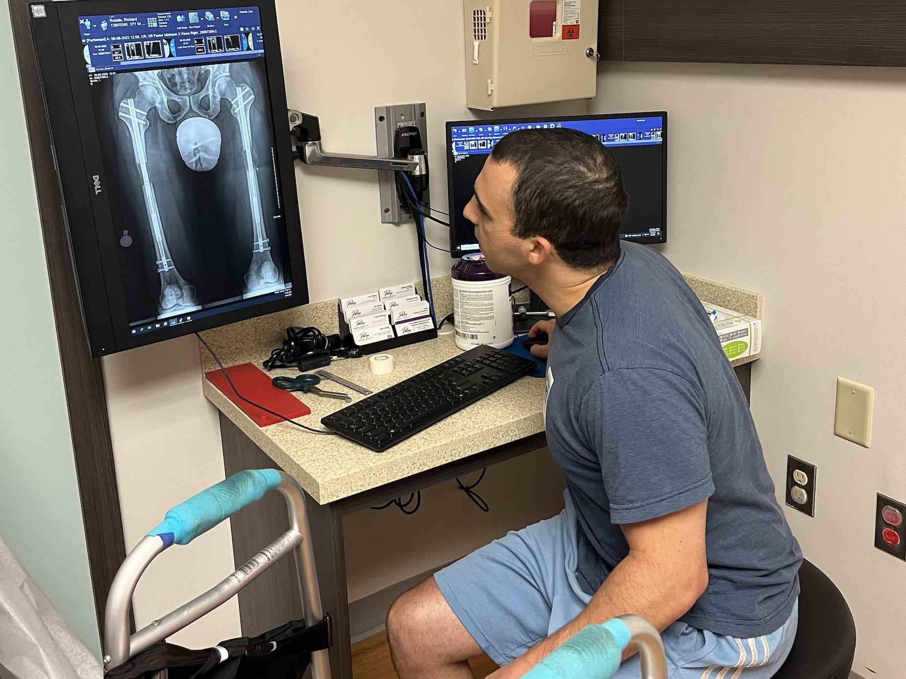 Rich Rotella sieht sich nach seiner Operation ein Röntgenbild von sich an.