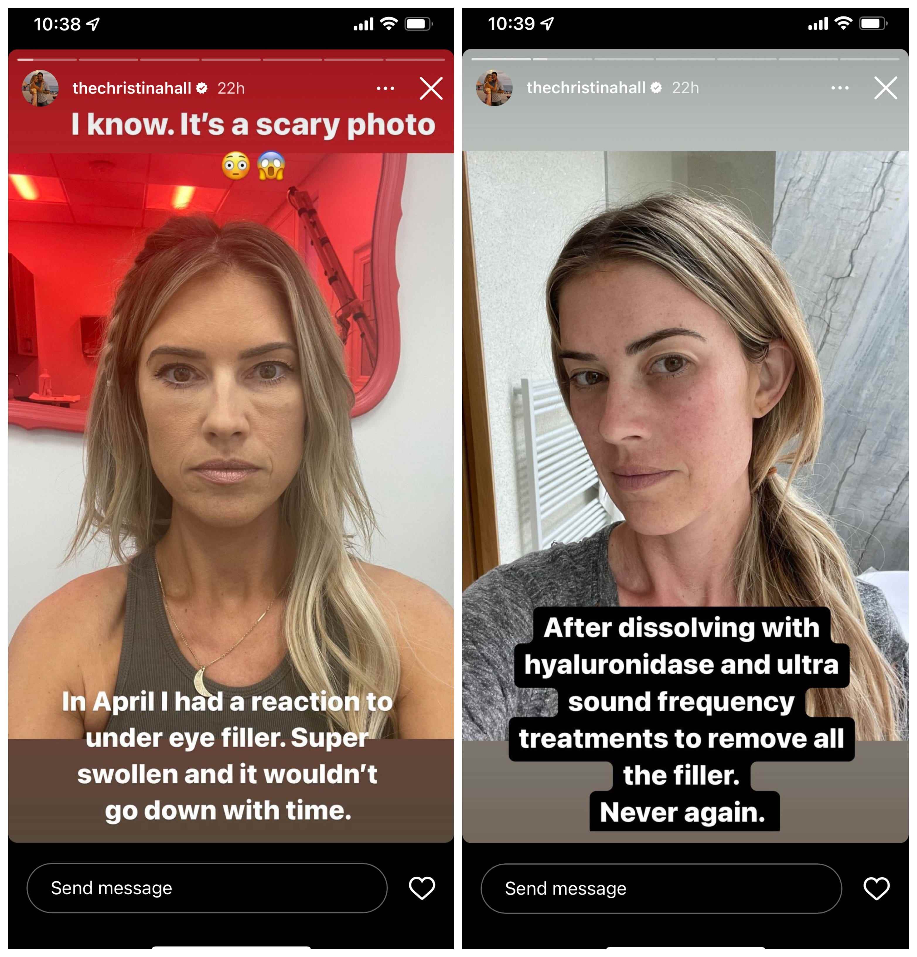 Christina Hall Instagram Stories Gesundheitsupdates