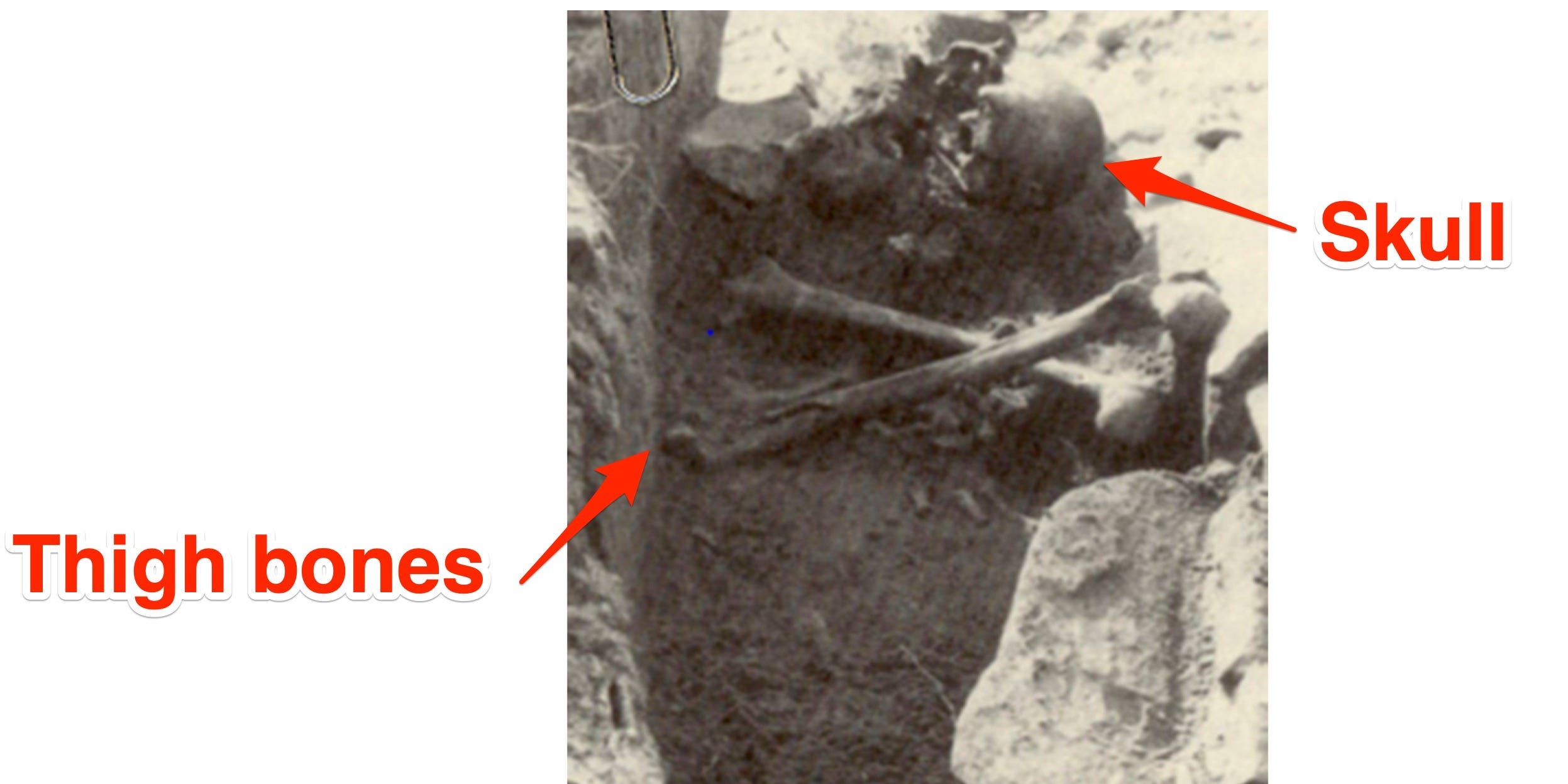 Ein Schwarz-Weiß-Bild zeigt einen nach unten gerichteten Schädel mit gekreuzten Oberschenkeln an der Brust des „Connecticut-Vampirs“ im Grab.
