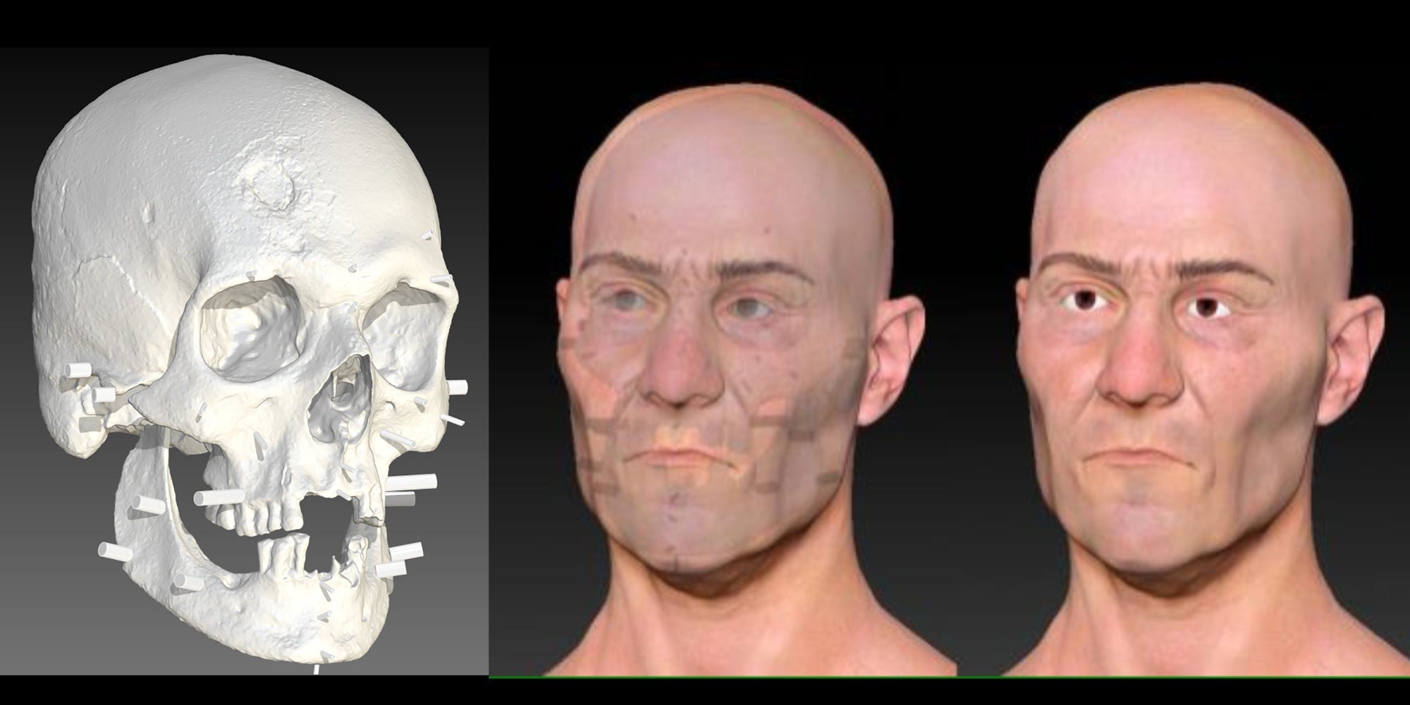 Die Abbildungen nebeneinander zeigen einen digitalen 3D-Scan des Schädels des Connecticut-Vampirs neben einer digitalen Rekonstruktion seines Gesichts, dem nach und nach Merkmale hinzugefügt werden.