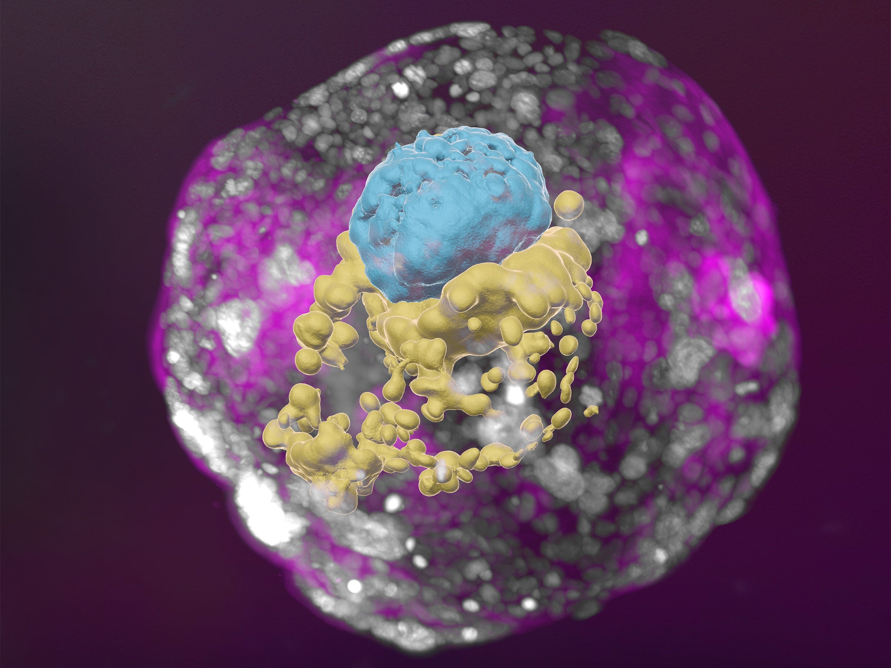 Ein aus Stammzellen gewonnenes menschliches Embryomodell in einem Entwicklungsstadium, das dem eines 14-Tage-Embryos entspricht.  Das Modell verfügt über alle Kompartimente, die dieses Stadium definieren: den Dottersack (gelb) und den Teil, der zum Embryo selbst wird, gekrönt vom Amnion (blau) – alles umhüllt von Zellen, die zur Plazenta werden (rosa).