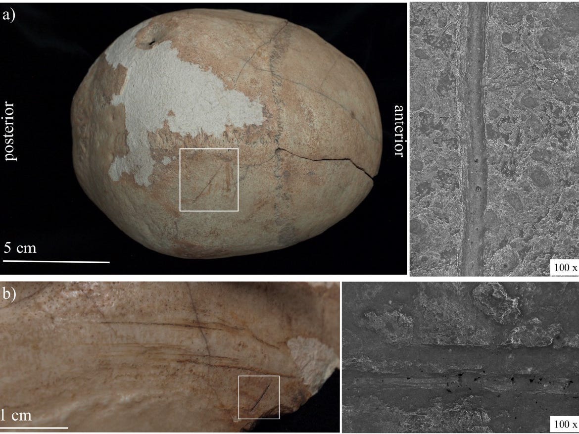Eine Collage aus Bildern einer Schädeldecke aus der Cueva de los Marmoles, die zeigt, wie Menschen sie verändert haben