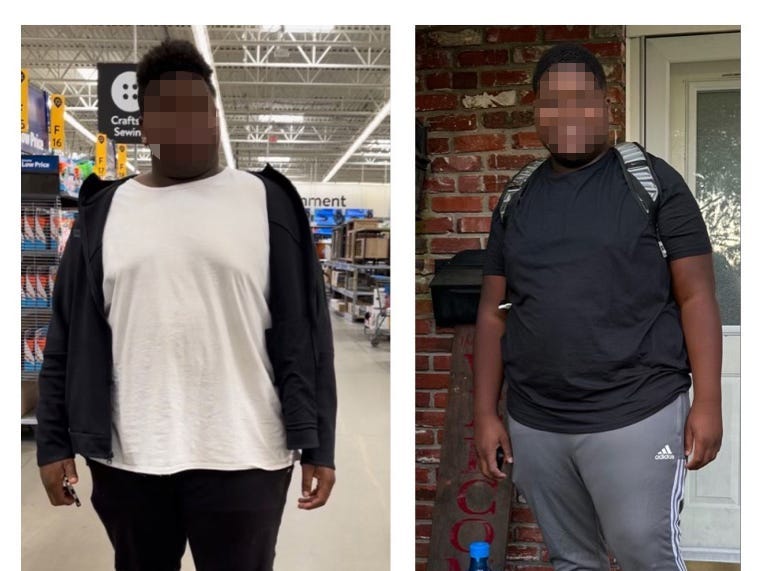 Ein direkter Vergleich vor und nach der Gewichtsabnahme eines Teenagers