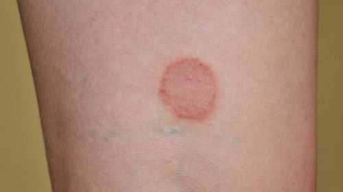 Identify skin diseases with these images
