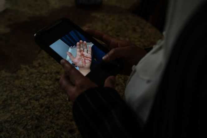 Palestinian activist Shatha Hammad shows on her phone a photo of the injury she suffered during a protest a few days earlier.  In Silwad (Palestine), June 30, 2021.