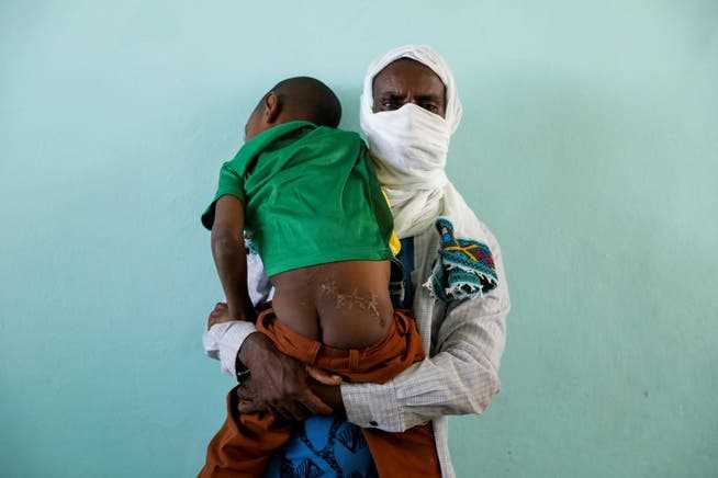 An Ethiopian farmer with his 5-year-old son who he said was shot when Ethiopian soldiers and their Amhara allies entered his village in the Tigray region on March 12th. 