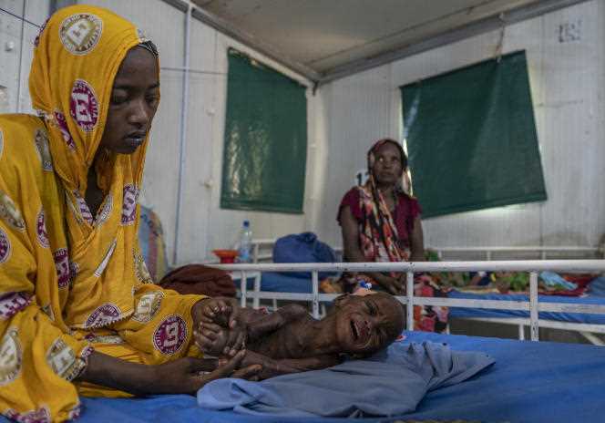 Adam Ali suffers from severe acute malnutrition syndrome due to protein deficiency, kwashiorkor.  He is treated in the unit managed by the NGO Alima and in partnership with the Chadian association Alerte Santé, at the Chad-China hospital in N'Djamena, on May 13, 2022.