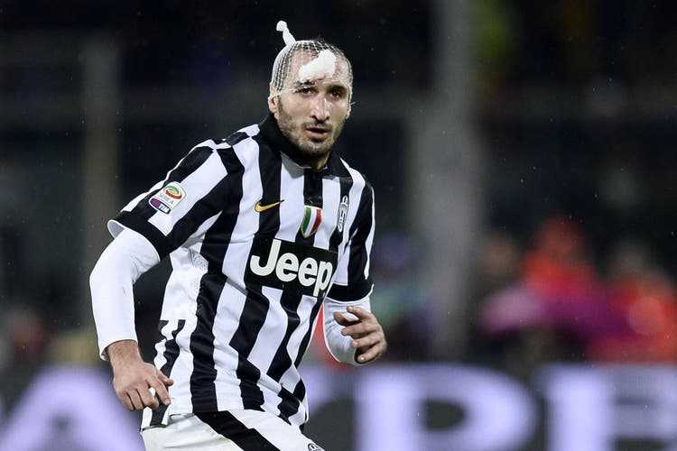 Giorgio Chiellini is used to playing with bandages on his head, here's a shot from 2014.