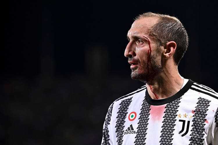 May 21, 2022: During the dernière for Juventus, in the away game against Fiorentina, blood drips down the face of the great fighter Chiellini again.