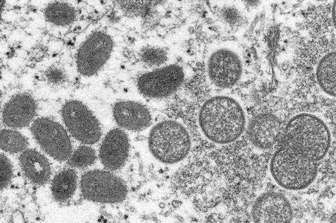 On the left, “monkeypox” cells observed under an electron microscope.