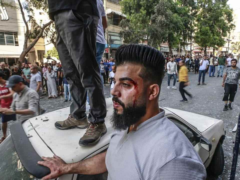An injured Palestinian stands at the site hit by Israeli attacks. 
