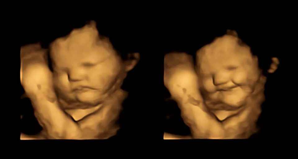 4d ultrasound scan babies