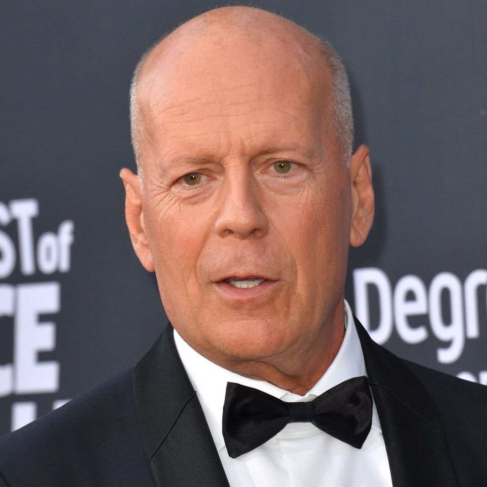 Actor Bruce Willis suffers from frontotemporal dementia.