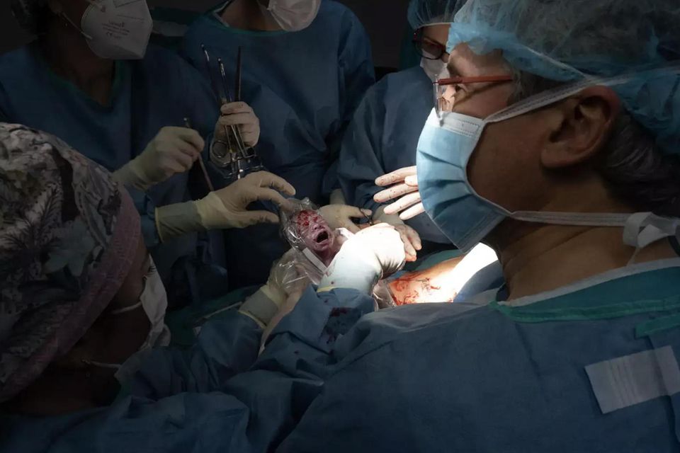 birth by cesarean section
