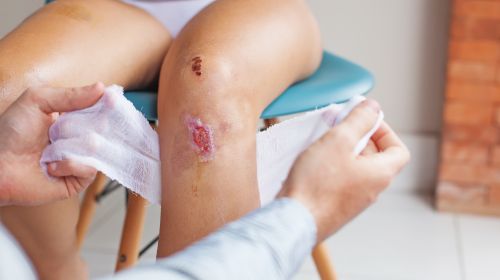 Accelerate wound healing – with these 20 tips it works
