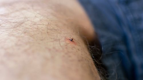 Tick ​​bite pictures: Recognize and react correctly