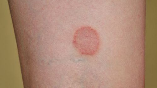 Detect skin diseases with these images