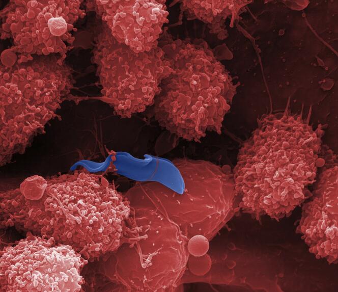 Sleeping sickness parasite.  Scanning electron micrograph of a “Trypanosoma brucei gambiense” parasite (in blue) and white blood cells (in red) in the liver of a mouse.