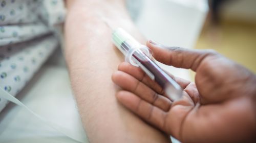 Blood count: Important blood values ​​and what they mean