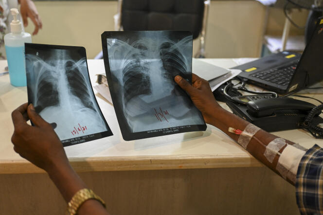 A tuberculosis patient views his chest X-rays at a Doctors Without Borders (MSF) clinic in Mumbai, India, March 22, 2022.